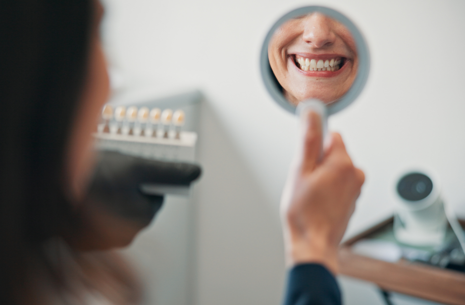 Teeth Whitening in Golders Green, North London
