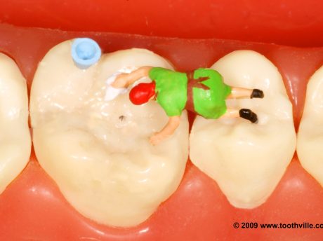 Why I Built My Career Around Minimally Invasive Dentistry
