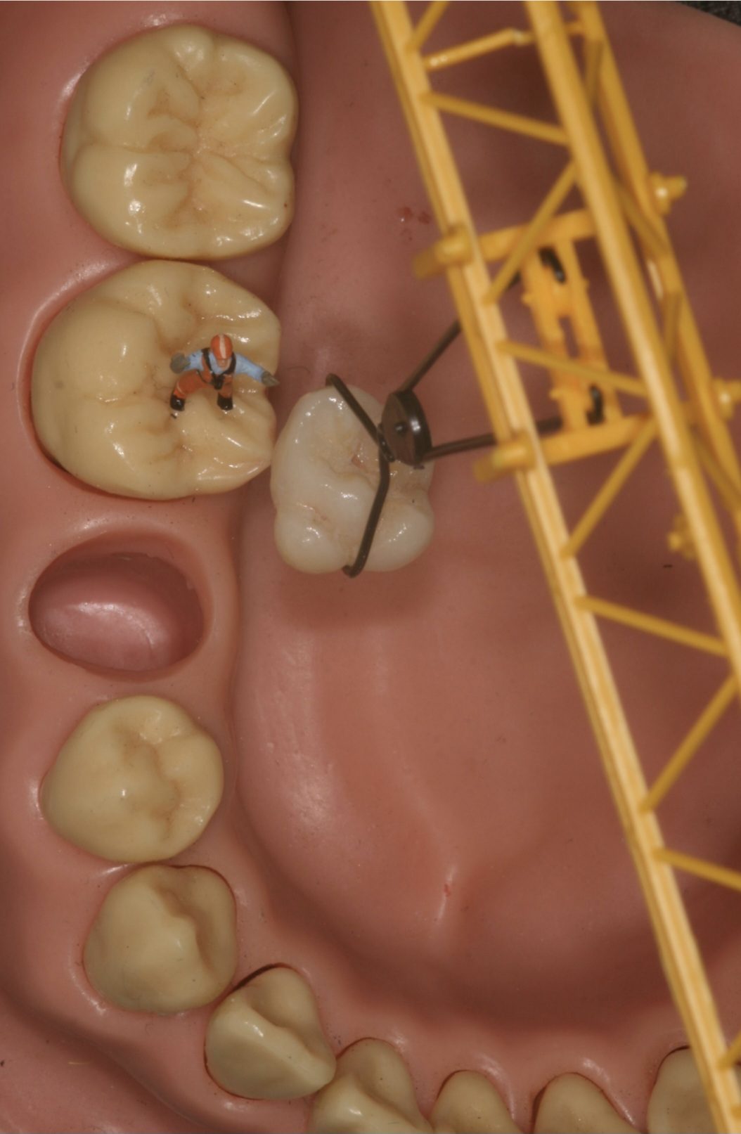 Tooth Inspection (cavity)